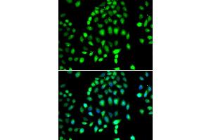 Immunofluorescence analysis of MCF-7 cells using PARP3 antibody. (PARP3 antibody)