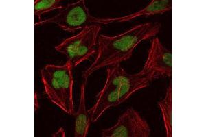 Immunofluorescence (IF) image for anti-Minichromosome Maintenance Complex Component 2 (MCM2) antibody (ABIN969281)