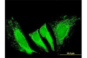 Immunofluorescence of purified MaxPab antibody to RTKN2 on HeLa cell. (RTKN2 antibody  (AA 1-163))