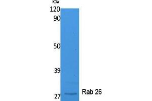 Western Blotting (WB) image for anti-RAB26, Member RAS Oncogene Family (RAB26) (C-Term) antibody (ABIN3187636) (RAB26 antibody  (C-Term))