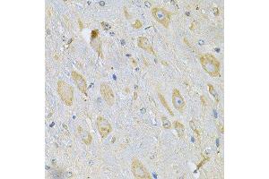 Immunohistochemistry of paraffin-embedded mouse brain using TXNDC5 Antibody. (TXNDC5 antibody  (AA 1-324))