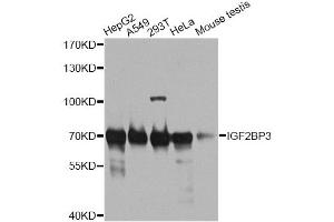 Western blot analysis of extracts of various cell lines, using IGF2BP3 antibody (ABIN6293021) at 1:1000 dilution. (IGF2BP3 antibody)