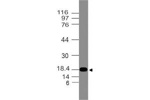 Image no. 1 for anti-Filaggrin Family Member 1 (FLG1) (AA 1-300) antibody (ABIN5027200) (Filaggrin-1 antibody  (AA 1-300))