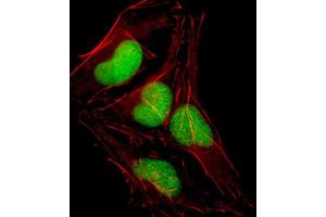 Immunofluorescence (IF) image for anti-SRY (Sex Determining Region Y)-Box 18 (SOX18) antibody (ABIN2998551) (SOX18 antibody)