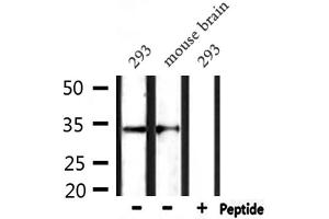 Western blot analysis of extracts from 293 and mouse brain, using CD38 Antibody. (CD38 antibody  (Internal Region))