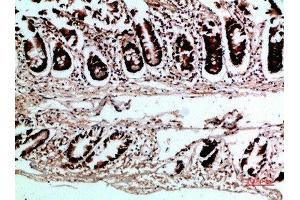 Immunohistochemical analysis of paraffin-embedded human-colon, antibody was diluted at 1:200 (VHL antibody  (AA 1-50))