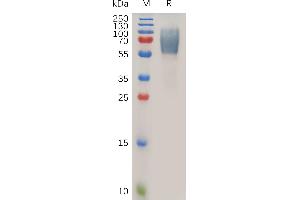 Human EMCN Protein, hFc Tag on SDS-PAGE under reducing condition. (Endomucin Protein (EMCN) (AA 19-190) (Fc Tag))