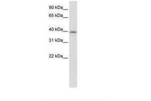 Image no. 1 for anti-Neurogenic Differentiation 6 (NEUROD6) (N-Term) antibody (ABIN6736162) (NEUROD6 antibody  (N-Term))