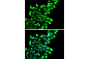 Immunofluorescence analysis of U2OS cells using MEST antibody. (MEST antibody)