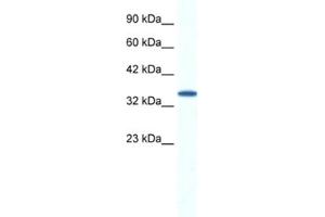 Western Blotting (WB) image for anti-Aryl Hydrocarbon Receptor Interacting Protein (AIP) antibody (ABIN2461590) (AIP antibody)