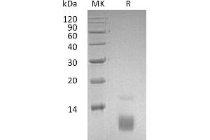 Greater than 95 % as determined by reducing SDS-PAGE. (CCL5 Protein)