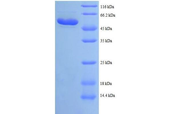 HADHB Protein (AA 35-283, partial) (GST tag)