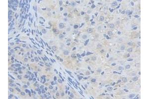 IHC-P analysis of Mouse Ovary Tissue, with DAB staining. (ALDH9A1 antibody  (AA 322-494))