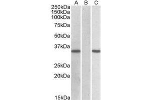 Western Blotting (WB) image for anti-Cysteine-Rich Secretory Protein 2 (CRISP2) (Internal Region) antibody (ABIN2464609) (CRISP2 antibody  (Internal Region))