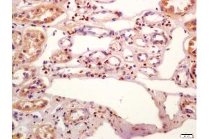 Formalin-fixed and paraffin embedded human kidney labeled with Anti-phospho-JunD(Ser255) Polyclonal Antibody, Unconjugated (ABIN802473) at 1:200 followed by conjugation to the secondary antibody and DAB staining (JunD antibody  (pSer255))