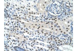 Semenogelin I antibody was used for immunohistochemistry at a concentration of 4-8 ug/ml to stain Epithelial cells of renal tubule (arrows) in Human Kidney. (SEMG1 antibody  (N-Term))