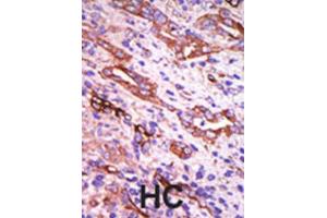 Immunohistochemistry (IHC) image for anti-G Protein-Coupled Receptor Kinase 1 (GRK1) antibody (ABIN3002923) (GRK1 antibody)