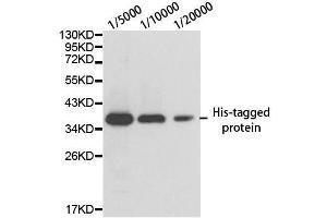 Western blot analysis of over-expressed His-tagged protein in 293T cell using His-tag antibody. (His Tag antibody)