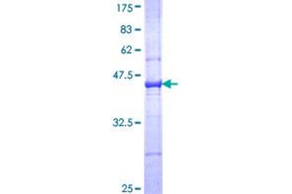 C3 Protein (AA 1534-1644) (GST tag)