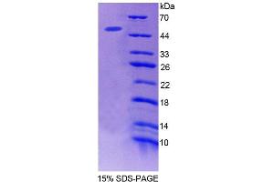 SDS-PAGE analysis of Mouse ACP6 Protein. (ACP6 Protein)