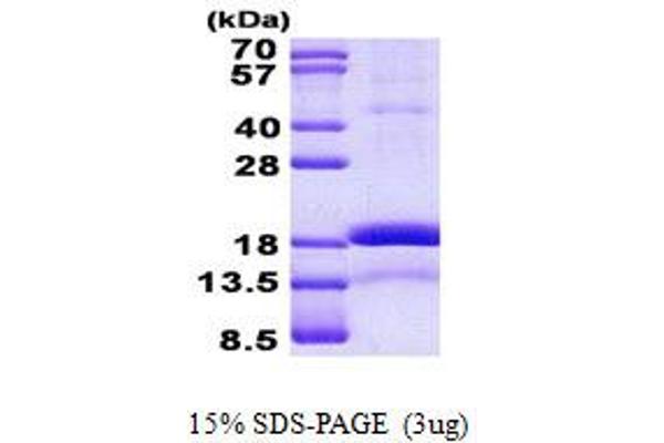 CHRAC1 Protein (His tag)