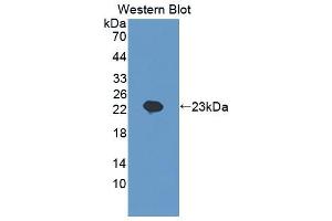 Figure. (SCEL antibody  (AA 519-685))