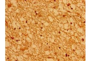 Immunohistochemistry of paraffin-embedded human brain tissue using ABIN7142982 at dilution of 1:100 (ASCL1 antibody  (AA 1-236))