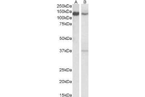 ABIN2613482 (0. (SRRT antibody  (C-Term))