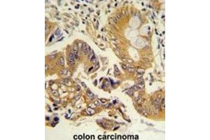 Immunohistochemistry (IHC) image for anti-Chloride Channel, Nucleotide-Sensitive, 1A (CLNS1A) antibody (ABIN3002661) (CLNS1A antibody)