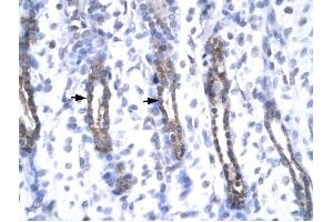 MMP19 antibody was used for immunohistochemistry at a concentration of 4-8 ug/ml to stain Epithelial cells (arrows) in Human Urinary bladder. (MMP19 antibody  (N-Term))