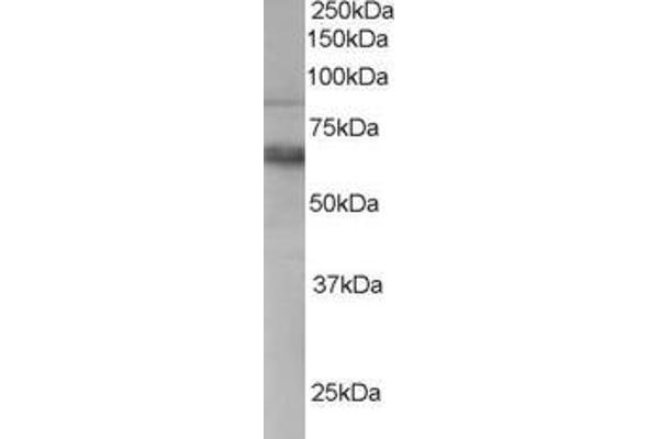 ANTXR1 antibody  (C-Term)