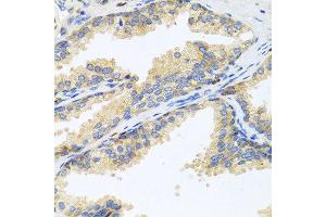 Immunohistochemistry of paraffin-embedded human prostate using WFDC2 antibody at dilution of 1:100 (40x lens). (WFDC2 antibody)