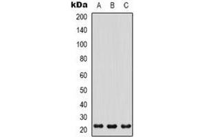 Western blot analysis of PGRP expression in HepG2 (A), HEK293T (B), Hela (C) whole cell lysates. (PGLYRP1 antibody)