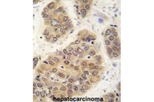 Immunohistochemistry (IHC) image for anti-Small Ubiquitin Related Modifier 4 (SUMO4) (Wild Type) antibody (ABIN2996872) (SUMO4 antibody  (Wild Type))