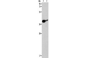 Western Blotting (WB) image for anti-Sirtuin 3 (SIRT3) antibody (ABIN2428697) (SIRT3 antibody)