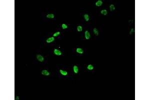 Immunofluorescent analysis of Hela cells using ABIN7139610 at dilution of 1:100 and Alexa Fluor 488-congugated AffiniPure Goat Anti-Rabbit IgG(H+L) (HIST1H3A antibody  (meLys9))