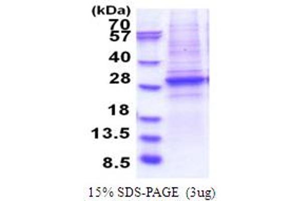 SMARCA4 Protein (AA 362-549) (His tag)