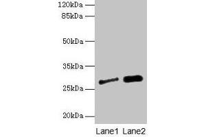 Western blot All lanes: IGFBP1 antibody at 3 μg/mL Lane 1: A549 whole cell lysate Lane 2: PC-3 whole cell lysate Secondary Goat polyclonal to rabbit IgG at 1/10000 dilution Predicted band size: 28 kDa Observed band size: 28 kDa (IGFBPI antibody  (AA 26-259))