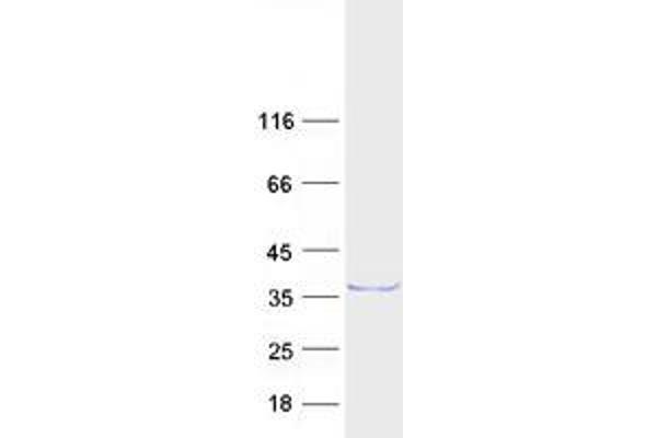 RYBP Protein (Myc-DYKDDDDK Tag)