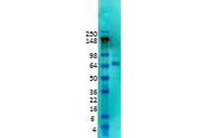 KCND2 antibody  (Extracellular Domain)