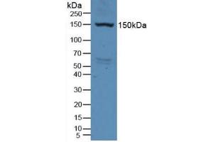 Western blot analysis of Rat Serum. (VEGFR2/CD309 antibody  (AA 46-320))