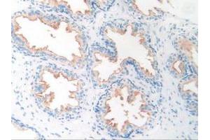 IHC-P analysis of Human Prostate Gland Tissue, with DAB staining. (PSMA antibody  (AA 274-587))