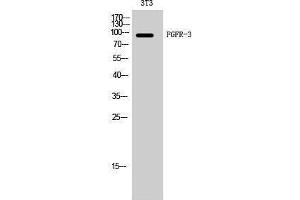 Western Blotting (WB) image for anti-Fibroblast Growth Factor Receptor 3 (FGFR3) (Internal Region) antibody (ABIN3175081) (FGFR3 antibody  (Internal Region))