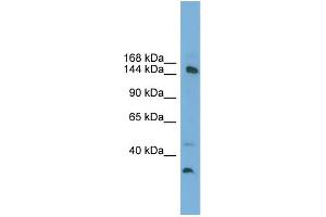 WB Suggested Anti-MED14  Antibody Titration: 0. (MED14 antibody  (Middle Region))