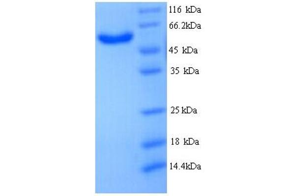 MICAL2 Protein (AA 1-495, partial) (His tag)