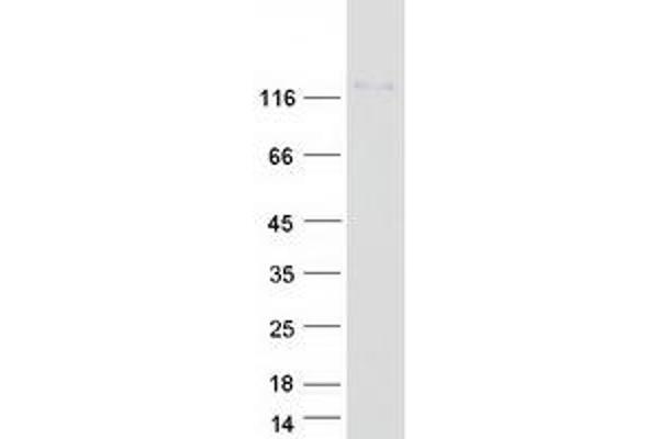 NFATC3 Protein (Transcript Variant 1) (Myc-DYKDDDDK Tag)