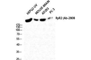 Western Blot analysis of HepG2-UV Mouse-BRAIN AD293 PC-3 cells using RyR-2 Polyclonal Antibody diluted at 1:2000. (RYR2 antibody)