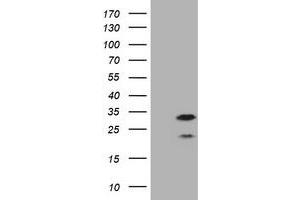 Image no. 2 for anti-Membrane-Spanning 4-Domains, Subfamily A, Member 1 (MS4A1) antibody (ABIN1497207) (CD20 antibody)