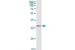 MS4A1 MaxPab rabbit polyclonal antibody. (CD20 antibody  (AA 1-297))