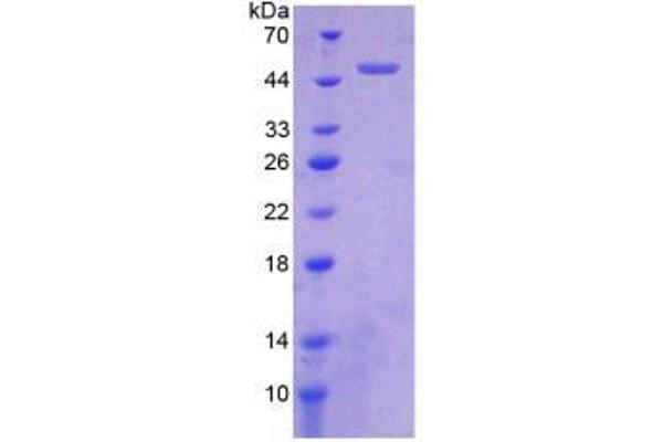 HTRA1 Protein